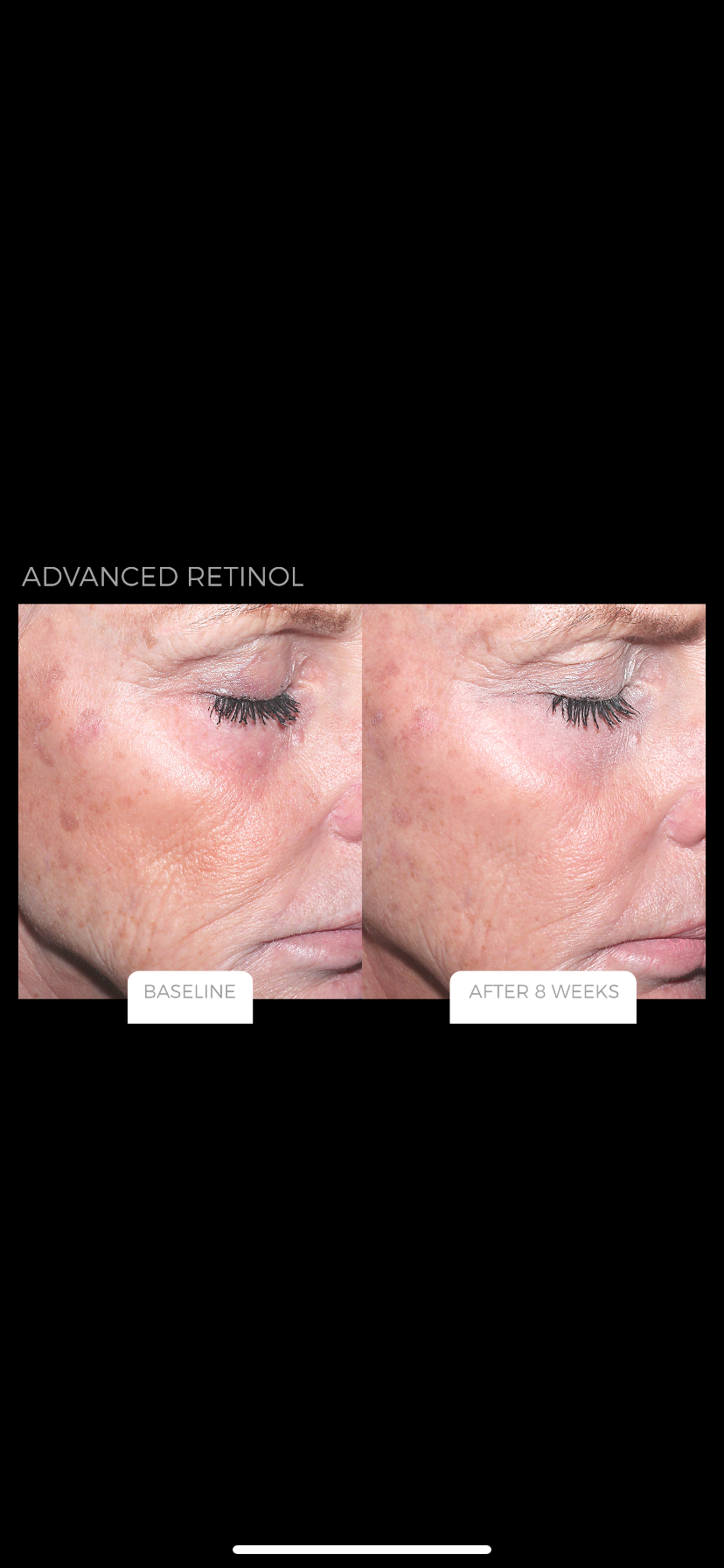 Advanced retinol